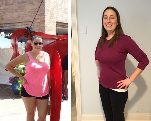 Weight loss specialist - before and after photo